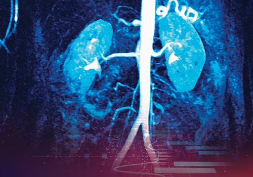 aside img of Insights from R&T Forum: Kidney care